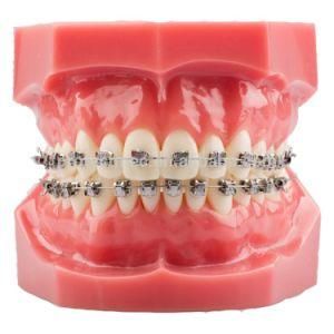 Orthodontic Dental Metal Bracket in Orthodontic Typodont