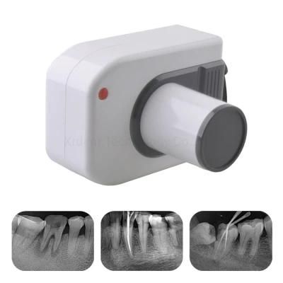 Hot Selling High Frequency Digital X-ray Imaging Dental Portable X-ray Equipment