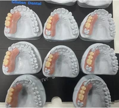 Tcs Valplast Denture/Flexible Denture/High Flexibility Valplast Denture/Unilateral Valplast