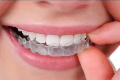Can Retainers Straighten Teeth Without Braces/Invisible Aligner Treatment Time