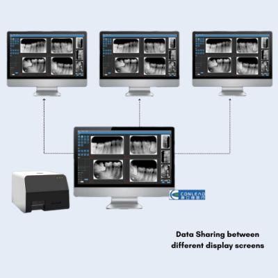 Advanced Digital X-ray Scanner for Size 0, 1, 2, 3, 4 Image Plates, with Data Sharing Function