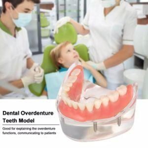 Manufacturers Direct Sales of High Quality PVC Removable 32 Dental Hospital Standard Tooth Model
