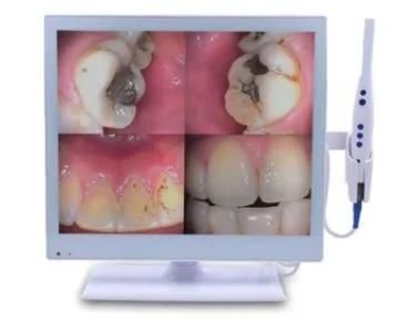 Dental Apparatus Medical Intraoral Camera All in One