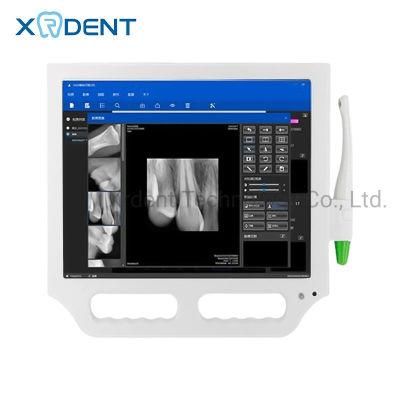 Hot Sale 17inch Touch Screen Oral Camera Connected Sensors China Medical Use