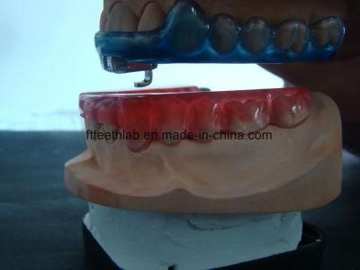 Affordable Anti-Snoring Device Made in China Dental Lab From Shenzhen China