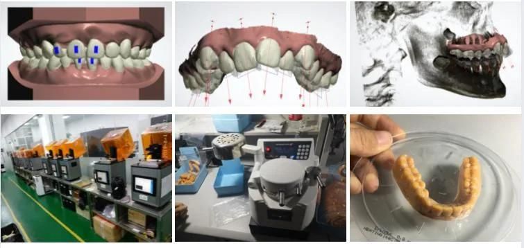 OEM Teeth Aligner Dental 3D Clear Aligners Orthodontics Brace with Quality Certifications