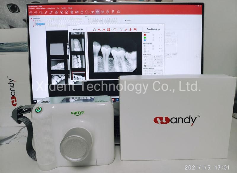 Low Dose Xray Wireless Portable Digital Dental X-ray Unit