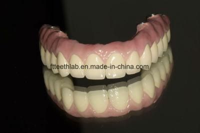 Full Bridge Dental Implants From China Dental Lab