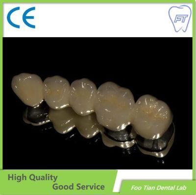 Factory Manufacture Zirconia Crown and Bridge Made From China Dental Lab