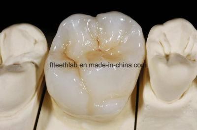 Full Contour Zirconia Crown From China Dental Lab