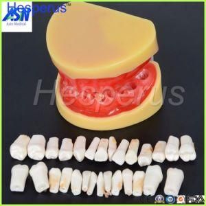 Dental All Teeth Removable Standard Teeth Tooth Model 28 PCS Teeth Student Learning Model Hesperus