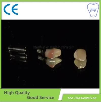 Dental Restoration Framework Dental Lab with High Quality