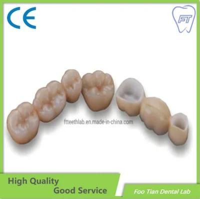 Foo Tian Manufacture Zirconium Crown Custom Dental Material Lab Implant Dental Lab Full Contour Without Porcelain
