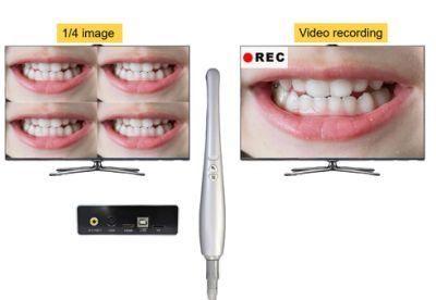 High Pixel TV Dental Camera 10 LEDs 2MP Macro Lens Best Digital Oral Viewer