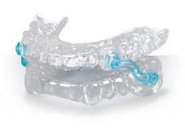 Dental Anti Snoring Appliance From China Dental Lab