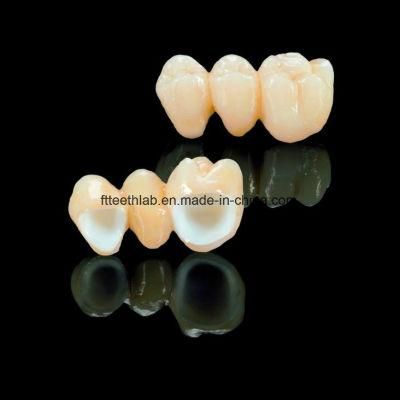 High Aesthetic Dental Zirconium Bridges From China Dental Lab