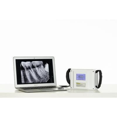 Portable Dental X-ray Digital Small Medical X-ray Machine with Rvg Sensor