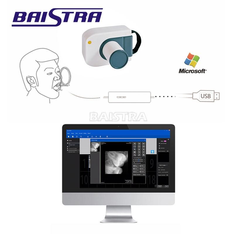 Cheap Price Intraoral Imaging Dental X-ray Digital Rvg Sensor USB X Ray Sensor