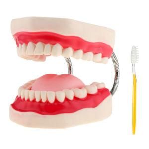 Demonstration Model of Tooth Decay and Caries Development Decayed Teeth Anatomical Model Teaching Resources Dentist Used