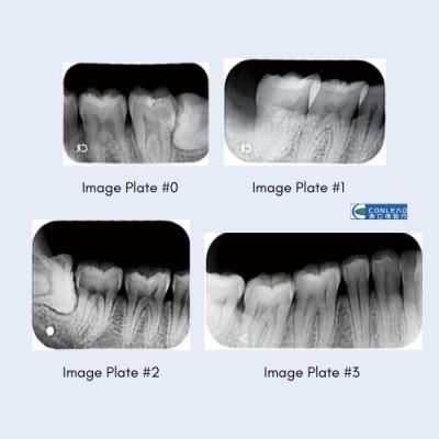 Digital X-ray Scanner for Size 0, 1, 2, 3 Image