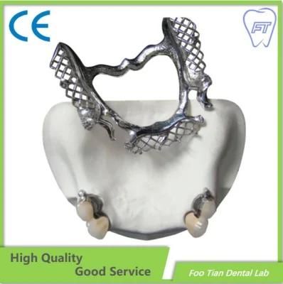 Selling About CAD/Cam Vitallium Metal Cast Partial Dentures From China Dental Lab