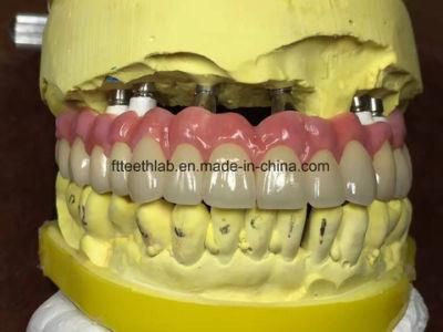Dental Material Lab Implant Dental Lab Long Zirconia Bridge Supported by Implants