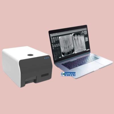 Automatic Digital Cr X-ray Imaging System (images ccan be obtained within 15 seconds)