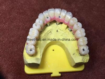 Full Arch Zirconium Implant Bridge From China Dental Lab