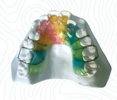Herbst Appliance From China Dental Lab