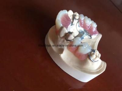 Dental Material Lab Implant Dental Lab Custom Dental Framework Denture