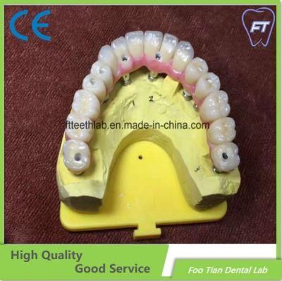 Dental Material Implant Supplies All-on-6 Full Contour Zirconia Upper Dental Implant Bridge
