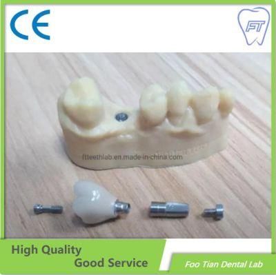 Telescopic Denture Veneer Oral Rehabilitation Nice Product