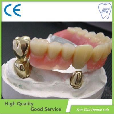 Good Service Bruxzir Solid Stable Zirconia Bridge From China Dental Lab on Selling