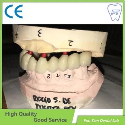Customized Zirconium Crown Custom Dental Material Lab Implant Dental Lab Full Contour Without Porcelain