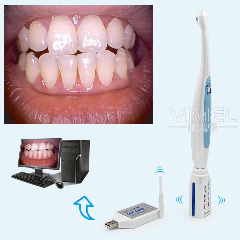 WiFi Dental Intraoral HD Oral Camera Wireless Endoscope