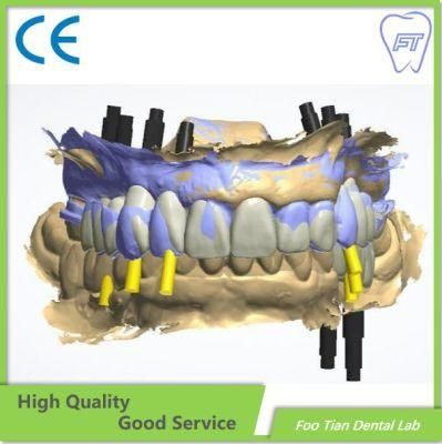 Dental Implant OEM Bruxzir Solid Stable Zirconia Bridge From China Dental Lab