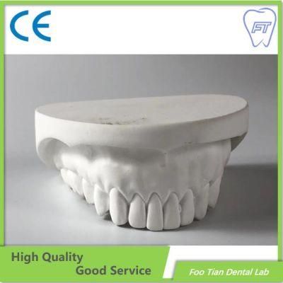 Factory Price Removable Denture Cast Partial Framework Dental Customized
