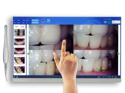 21.5 Inch 1080P Full Touch Screen Windows OS Intraoral Camera System Elegant Design