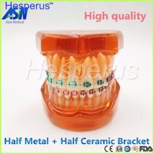 Teeth Model with Metal &amp; Ceramic Brackets Irregular Tooth Ortho Metal Dentist Patient Student Learning