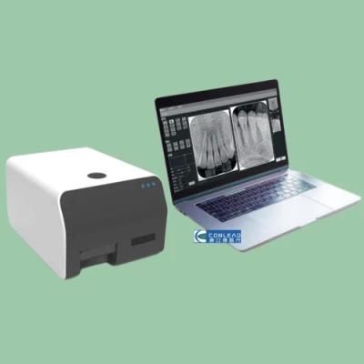 Automatic Dental Digital Intraoral Cr Imaging Plate Scanner