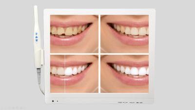 17 Inch Multimedia Dental Oral Camera 6 LEDs 1/4 Screen Preview VGA Ports Connection