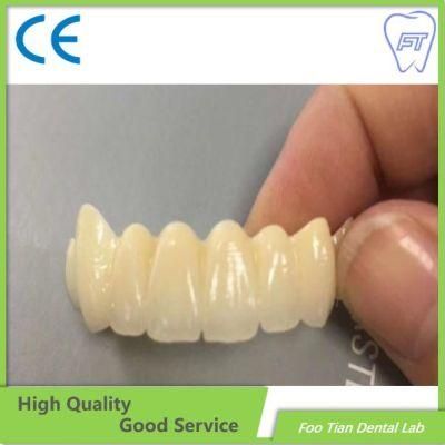 Hot Sale Bruxzir Solid Stable Zirconia Bridge From China Dental Lab