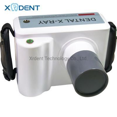 Dental Supply Professional Digital Portable Dental X Ray Equipment