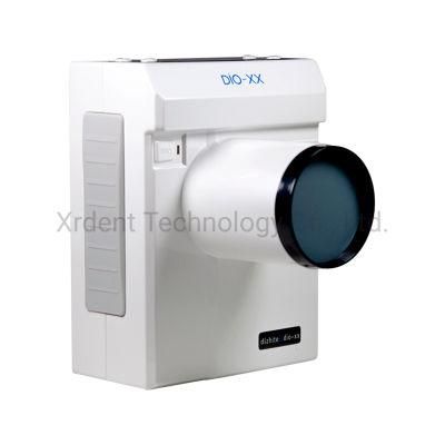 60kv 2mA Dio Korean Dental Portable X-ray Unit for Dental