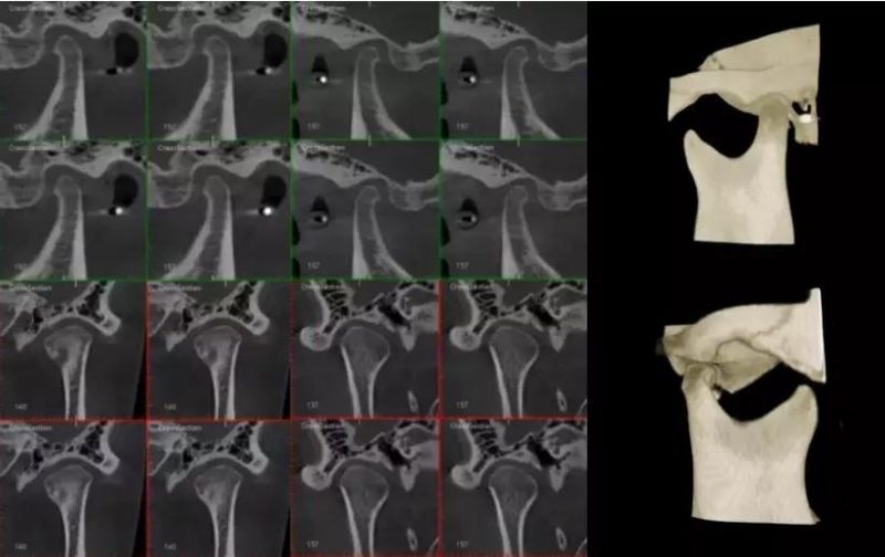 Hires 3D-Plus CE Professional Large Fov Dental 3D Cone Beam Computred Tomography Cbct Equipment