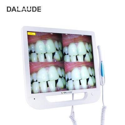 Dental Equipment Integration Intra Oral Camera