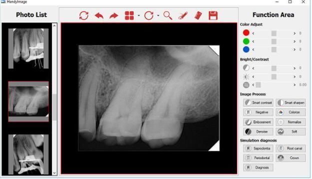Medical X-ray Equipments Intraoral Xray Sensor Dental Digital Sensor USB