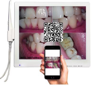 Wired HD Intra Oral Camera with Multimedia Monitor