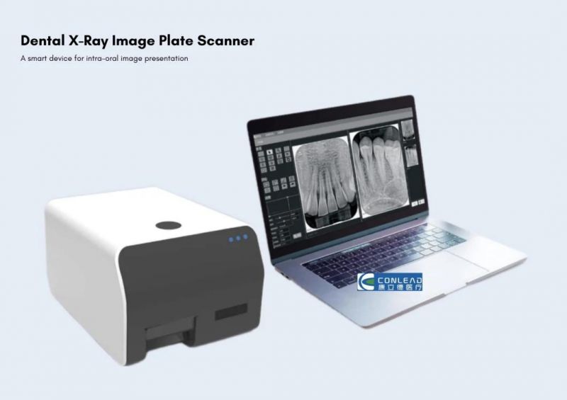 Automatic Dental Digital Intraoral Cr Imaging Plate Scanner