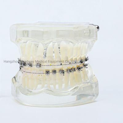 Dental Orthodontic Monocrystalline Sapphire Brackets with CE/ISO /FDA